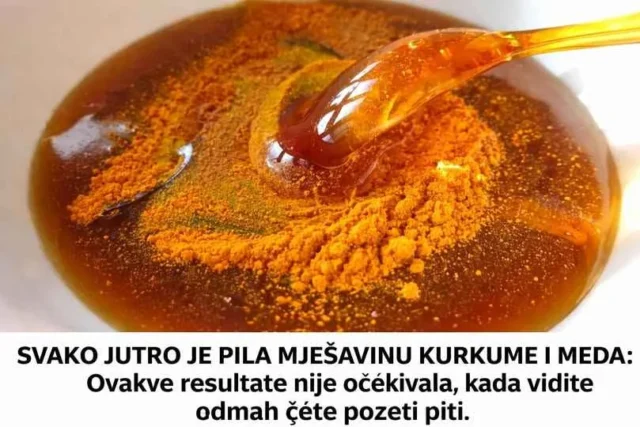 SVAKO JUTRO JE PILA MJEŠAVINU KURKUME I MEDA: Ovakve rezultate nije očekivala