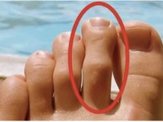 DOBRO POGLEDAJTE PRSTE NA NOGAMA: Ukoliko je drugi prst duži od ostalih, to nije SLUČAJNO!