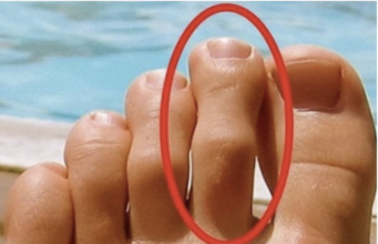 DOBRO POGLEDAJTE PRSTE NA NOGAMA: Ukoliko je drugi prst duži od ostalih, to nije SLUČAJNO!