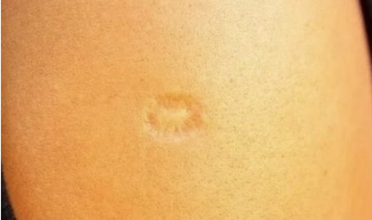 AKO STE ROĐENI U JUGOSLAVIJI SIGURNO IMATE OVAJ OŽILJAK NA RUCI: Znate li kako je nastao? SVI SU IZNENAĐENI