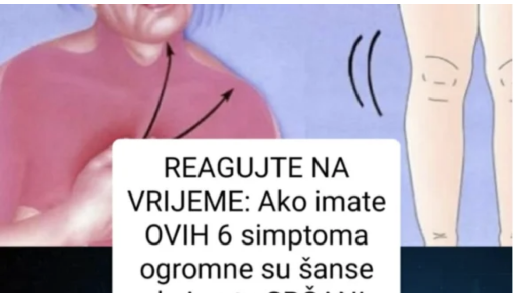 simptomi srčanog udara