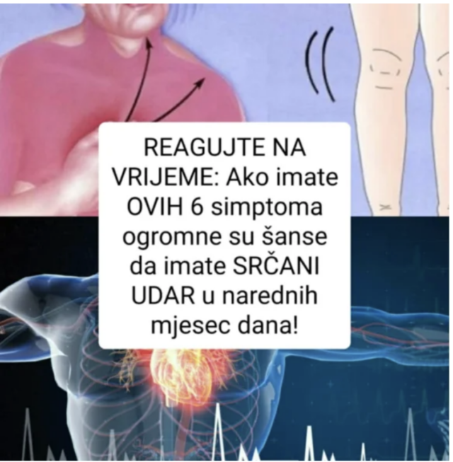 simptomi srčanog udara