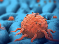 33 STVARI KOJE JE NAUKA POVEZALA SA RAKOM: Na 1. mjestu je ŠEĆER, a na 13. nešto što će vas posebno IZNENADITI!